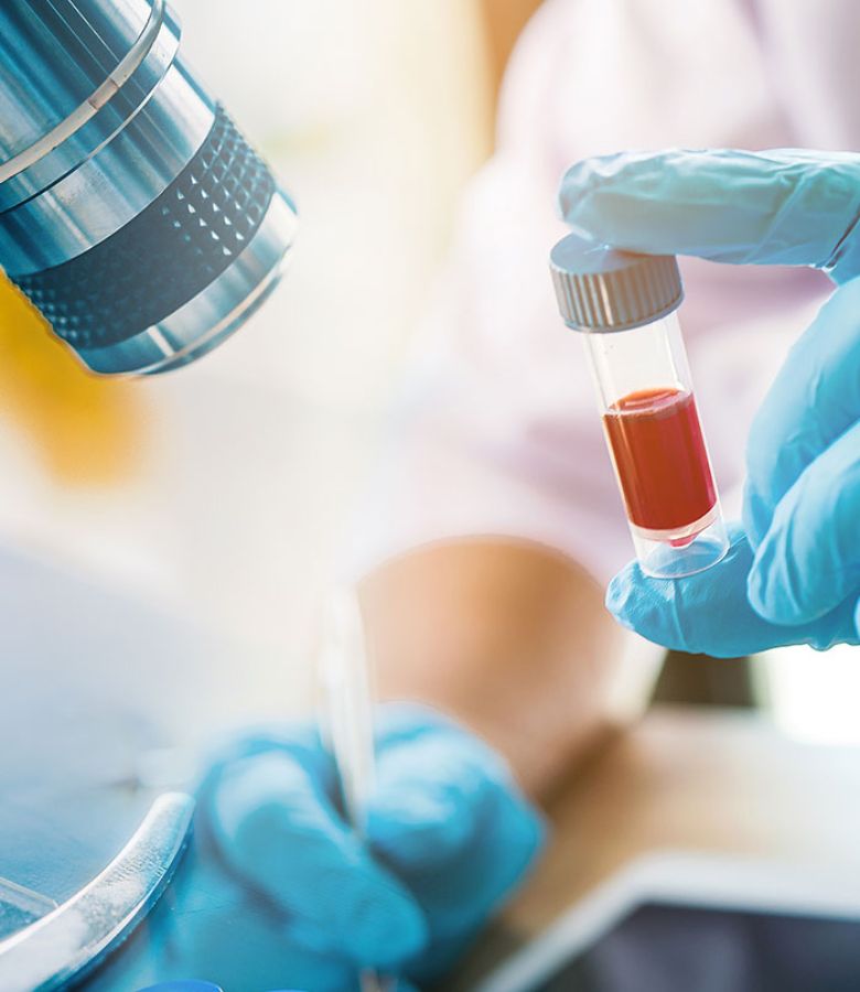 Lab Home Testing in Dubai: Fast, Reliable & Convenient Health Checks